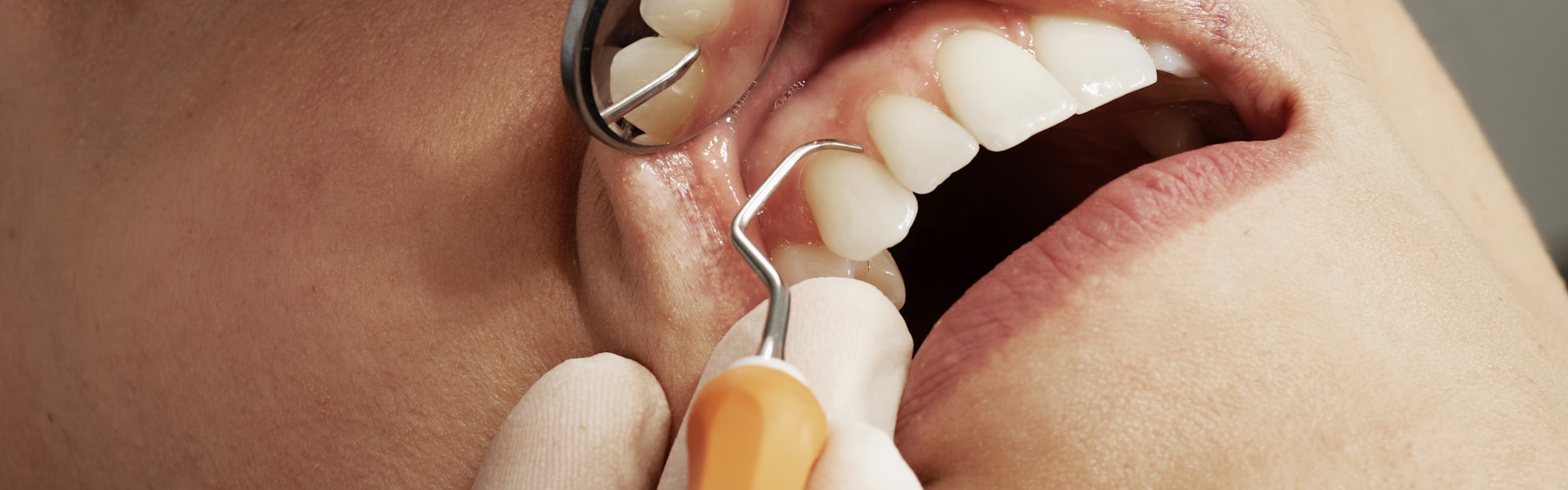 Dental Care